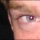 Easy Solutions to Avoid or Reduce Red-Eye