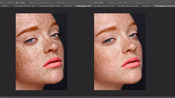 Blending mode for enhancing freckles