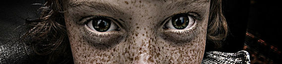 Charming Photographs of Freckles